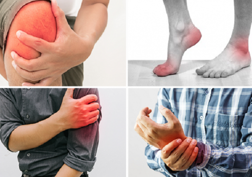 Giảm đau xương khớp vào mùa Đông