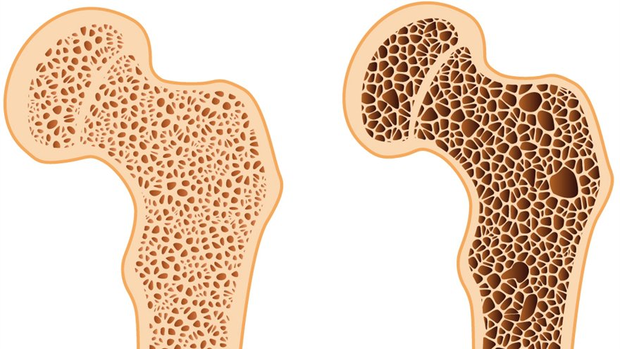 20210305_044029_270914_lao-hoa-gay-mat-do-.max-1800x1800