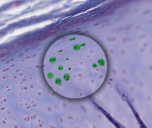 tế-bào-sụn-300x253